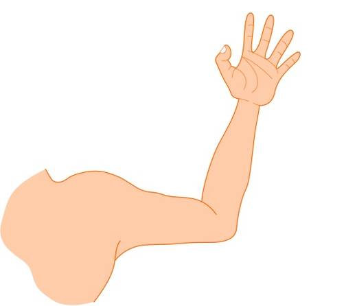 367-brazo.jpg